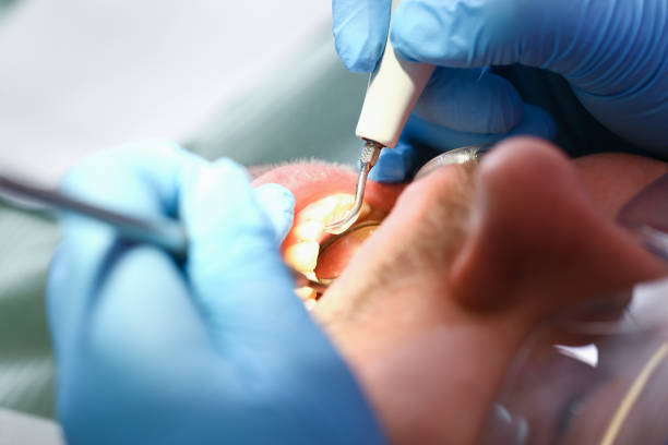 Best Broken or Cracked Tooth Emergency Dentist in Galesburg, MI